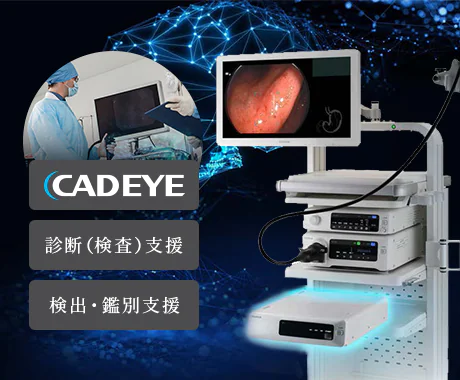AI技術を搭載する内視鏡画像診断支援システムでより正確な診断を