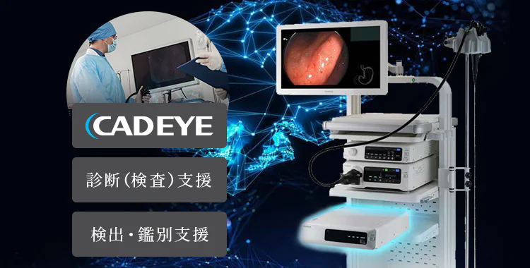 AI技術を搭載する内視鏡画像診断支援システムでより正確な診断を