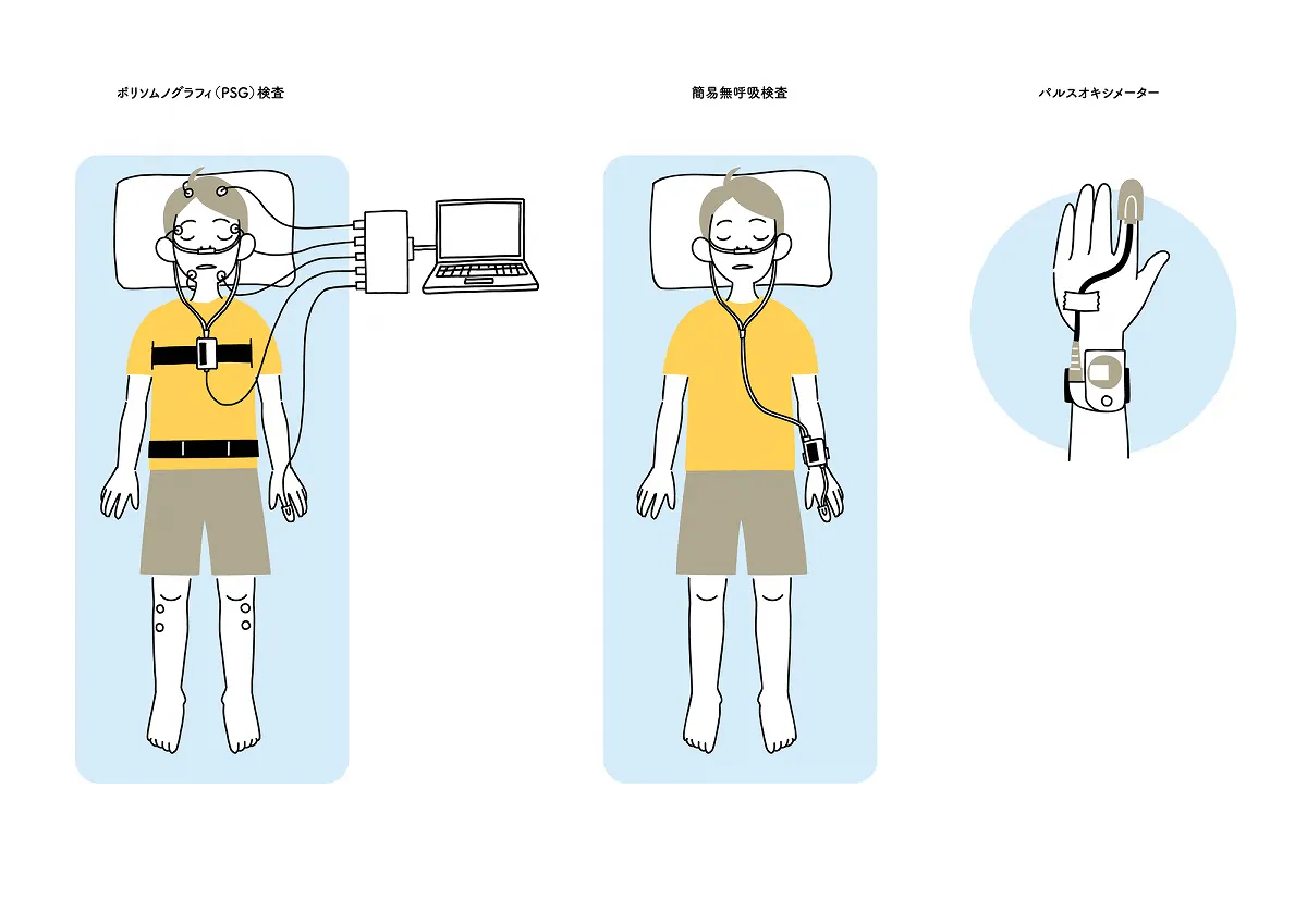 睡眠時無呼吸症候群の検査